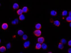 Invitrogen IFNAR1 Recombinant Rabbit Monoclonal Antibody (110) 100 &mu;L;