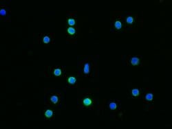 Invitrogen IFNGR1 Recombinant Rabbit Monoclonal Antibody (062) 100 &mu;L;