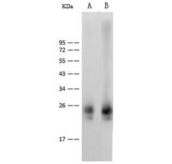 Invitrogen IL36B Recombinant Rabbit Monoclonal Antibody (110) 100 &mu;L;