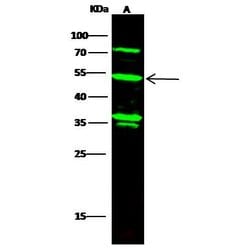 Invitrogen KYNU Recombinant Rabbit Monoclonal Antibody (004) 100 &mu;L;