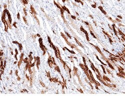 Invitrogen MEP1A Recombinant Rabbit Monoclonal Antibody (001) 100 &mu;L;