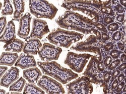 Invitrogen PDI Recombinant Rabbit Monoclonal Antibody (023) 100 &mu;L;