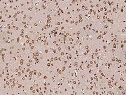 Invitrogen PDI Recombinant Rabbit Monoclonal Antibody (023) 100 &mu;L;