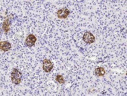 Invitrogen Podoplanin Recombinant Rabbit Monoclonal Antibody (066) 100