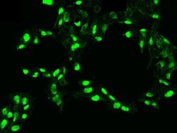Invitrogen PDGF-C Recombinant Rabbit Monoclonal Antibody (004) 100 &mu;L;