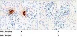 Invitrogen Renin Recombinant Rabbit Monoclonal Antibody (1) 100 &mu;L;