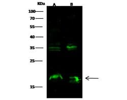 Invitrogen Syndecan 4 Recombinant Rabbit Monoclonal Antibody (112) 100