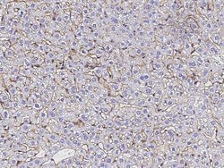 Invitrogen SERPINF2 Recombinant Rabbit Monoclonal Antibody (128) 100 &mu;L;