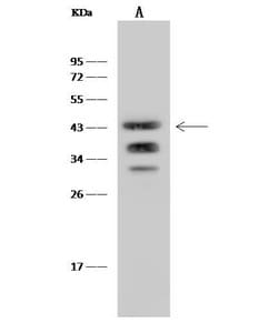 Invitrogen Ly-108 Recombinant Rabbit Monoclonal Antibody (040) 100 &mu;L;