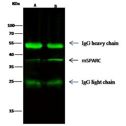 Invitrogen SPARC Recombinant Rabbit Monoclonal Antibody (001) 100 &mu;L;