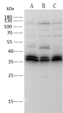 Invitrogen TROP2 Recombinant Rabbit Monoclonal Antibody (064) 100 &mu;L;