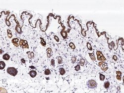 Invitrogen TROP2 Recombinant Rabbit Monoclonal Antibody (046) 100 &mu;L;