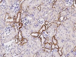 Invitrogen TROP2 Recombinant Rabbit Monoclonal Antibody (046) 100 &mu;L;