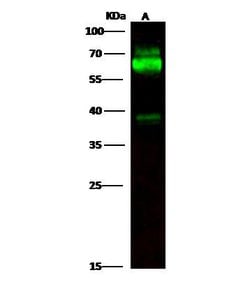 Invitrogen Tyrosine Hydroxylase Recombinant Rabbit Monoclonal Antibody
