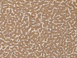 Invitrogen IGFBP2 Monoclonal Antibody (05) 100 &mu;L | Buy Online | Invitrogen&trade; | Fisher Scientific