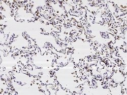 Invitrogen SFTPD Recombinant Rabbit Monoclonal Antibody (001) 100 &mu;L;