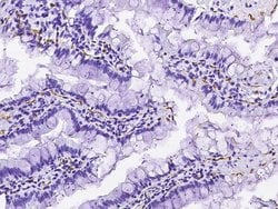 Invitrogen CD36 Recombinant Rabbit Monoclonal Antibody (002) 100 &mu;L;
