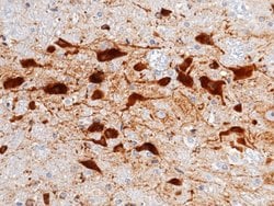 Invitrogen Cystatin C Recombinant Rabbit Monoclonal Antibody (001) 100