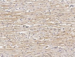 Invitrogen Desmocollin 2 Recombinant Rabbit Monoclonal Antibody (003) 100