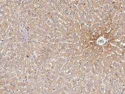 Invitrogen Transferrin Recombinant Rabbit Monoclonal Antibody (005) 100 &mu;L | Buy Online | Invitrogen&trade; | Fisher Scientific