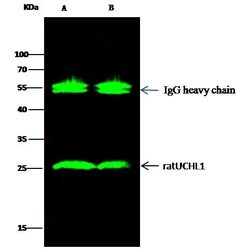 Invitrogen PGP9.5 Recombinant Rabbit Monoclonal Antibody (012) 100 &mu;L;