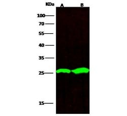 Invitrogen PGP9.5 Recombinant Rabbit Monoclonal Antibody (012) 100 &mu;L;
