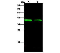 Invitrogen Ebola Virus VP40 (subtype Bundibugyo, strain Uganda 2007) Monoclonal Antibody (04) 100 &mu;L | Buy Online | Invitrogen&trade; | Fisher Scientific