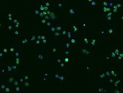 Invitrogen Cathepsin Z Recombinant Rabbit Monoclonal Antibody (009) 100