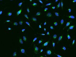 Invitrogen IGFBP7 Recombinant Rabbit Monoclonal Antibody (003) 100 &mu;L;