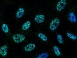 Invitrogen SAE1 Monoclonal Antibody (01) 100 &mu;L | Buy Online | Invitrogen&trade; | Fisher Scientific