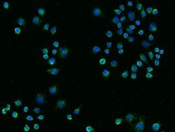 Invitrogen&trade;&nbsp;TREM2 Recombinant Rabbit Monoclonal Antibody (014)
