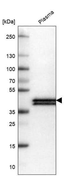 Invitrogen Apolipoprotein L1 Monoclonal Antibody (CL0170) 100 &mu;L; Unconjugated:Antibodies,