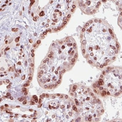 Invitrogen Emerin Monoclonal Antibody (CL0201) 100 &mu;L; Unconjugated:Antibodies,