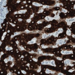 SLC27A5 Monoclonal Antibody (CL0215), Invitrogen 100 &mu;L; Unconjugated:Antibodies,