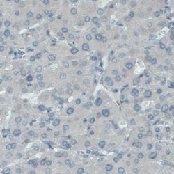 SLC27A5 Monoclonal Antibody (CL0215), Invitrogen 100 &mu;L; Unconjugated:Antibodies,
