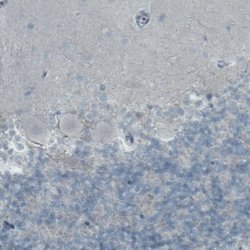 SLC27A5 Monoclonal Antibody (CL0215), Invitrogen 100 &mu;L; Unconjugated:Antibodies,