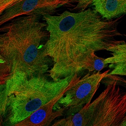 Invitrogen S100A4 Monoclonal Antibody (CL0239) 100 &mu;L; Unconjugated:Antibodies,