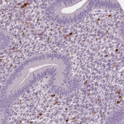 Invitrogen S100A4 Monoclonal Antibody (CL0239) 100 &mu;L; Unconjugated:Antibodies,