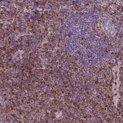 Invitrogen S100A4 Monoclonal Antibody (CL0239) 100 &mu;L; Unconjugated:Antibodies,