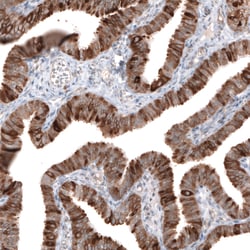 Invitrogen HMGCR Monoclonal Antibody (CL0259) 100 &mu;L; Unconjugated:Antibodies,