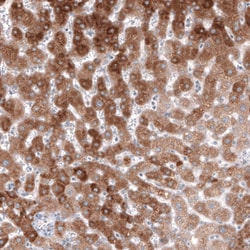 Invitrogen HMGCR Monoclonal Antibody (CL0259) 100 &mu;L; Unconjugated:Antibodies,
