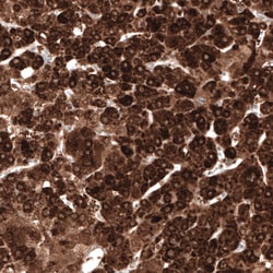 Invitrogen HMGCR Monoclonal Antibody (CL0259) 100 &mu;L; Unconjugated:Antibodies,