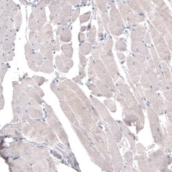 Invitrogen HMGCR Monoclonal Antibody (CL0259) 100 &mu;L; Unconjugated:Antibodies,
