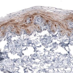 Invitrogen HMGCR Monoclonal Antibody (CL0259) 100 &mu;L; Unconjugated:Antibodies,