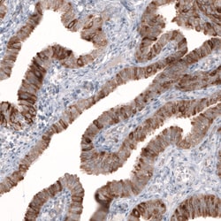 Invitrogen HMGCR Monoclonal Antibody (CL0260) 100 &mu;L; Unconjugated:Antibodies,