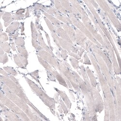 Invitrogen HMGCR Monoclonal Antibody (CL0260) 100 &mu;L; Unconjugated:Antibodies,