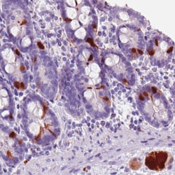 Invitrogen SCGN Monoclonal Antibody (CL0271) 100 &mu;L; Unconjugated:Antibodies,