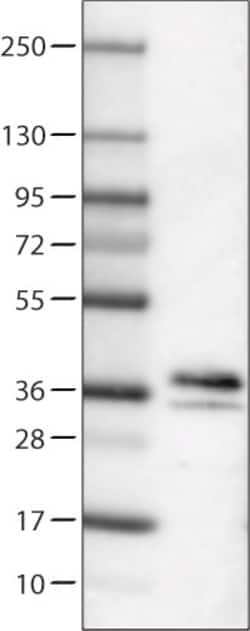 Invitrogen SCGN Monoclonal Antibody (CL0271) 100 &mu;L; Unconjugated:Antibodies,