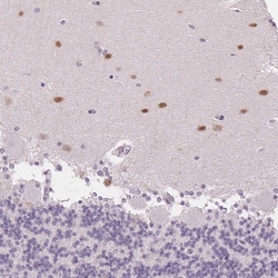 Invitrogen SCGN Monoclonal Antibody (CL0273) 100 &mu;L; Unconjugated:Antibodies,