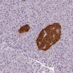 Invitrogen SCGN Monoclonal Antibody (CL0273) 100 &mu;L; Unconjugated:Antibodies,